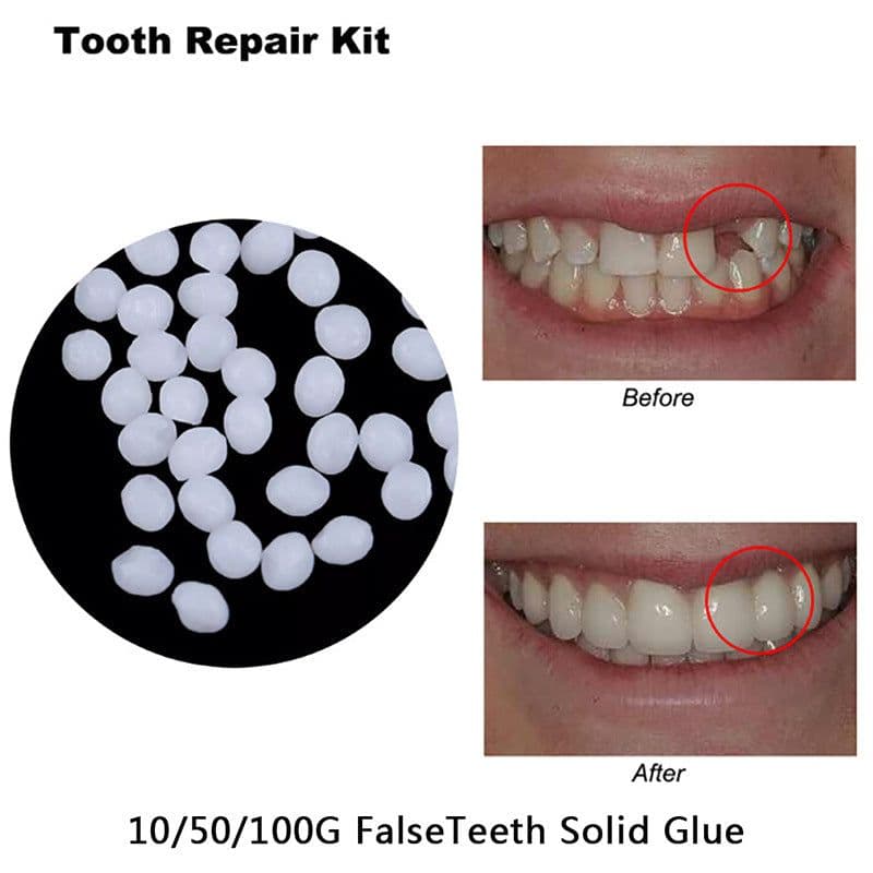 image-Temporary Dental Filling Material Gutta-Percha 50g