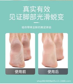 image-Electric Foot File Callus Remover Rechargeable Pedicure Tool