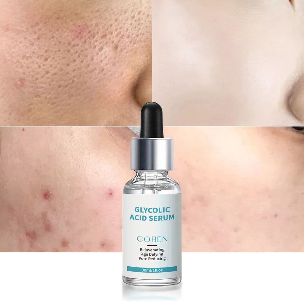 image-Glycolic Acid Essence Moisturizing Serum