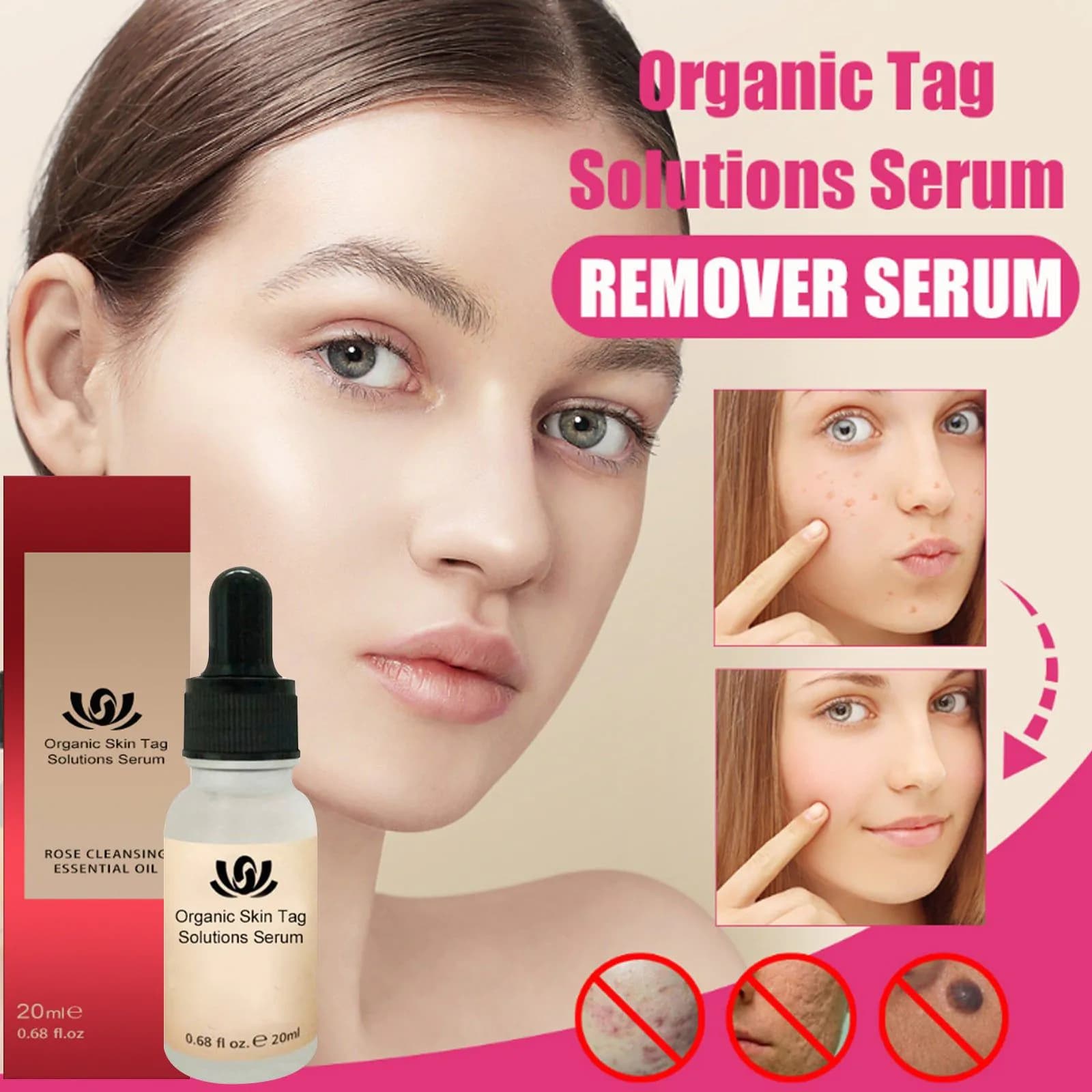 image-Facial Mole Removal Cream with Scar Prevention