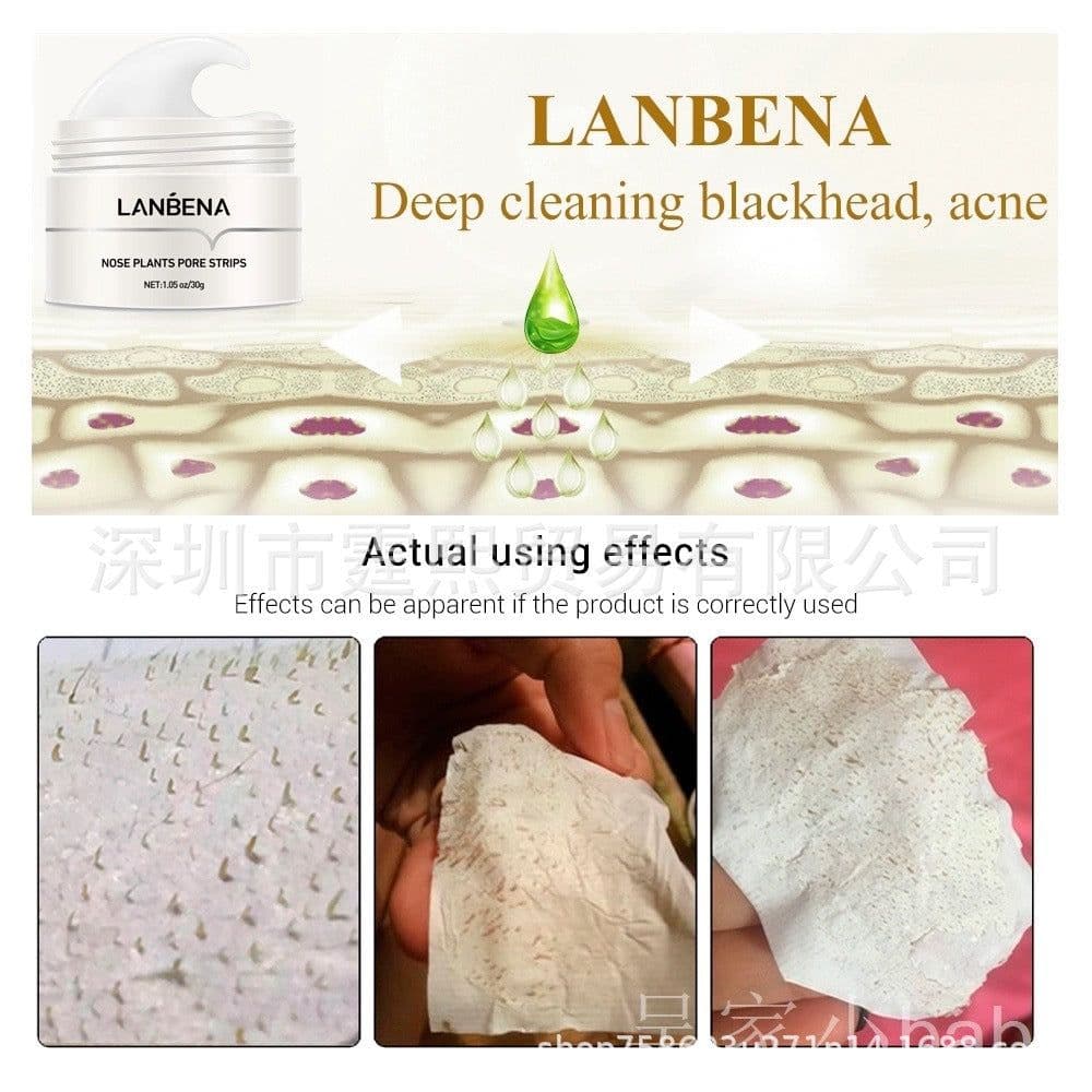 image-LANBENA Blackhead Remover Nose Strips Pore Cleansing Patches