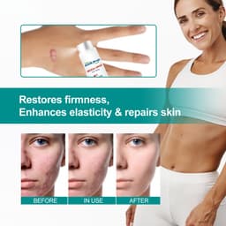 image-South Moon Scar Care Spray for Pregnancy and Surgery Scars