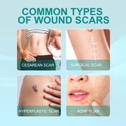 image-South Moon Scar Care Spray for Pregnancy and Surgery Scars