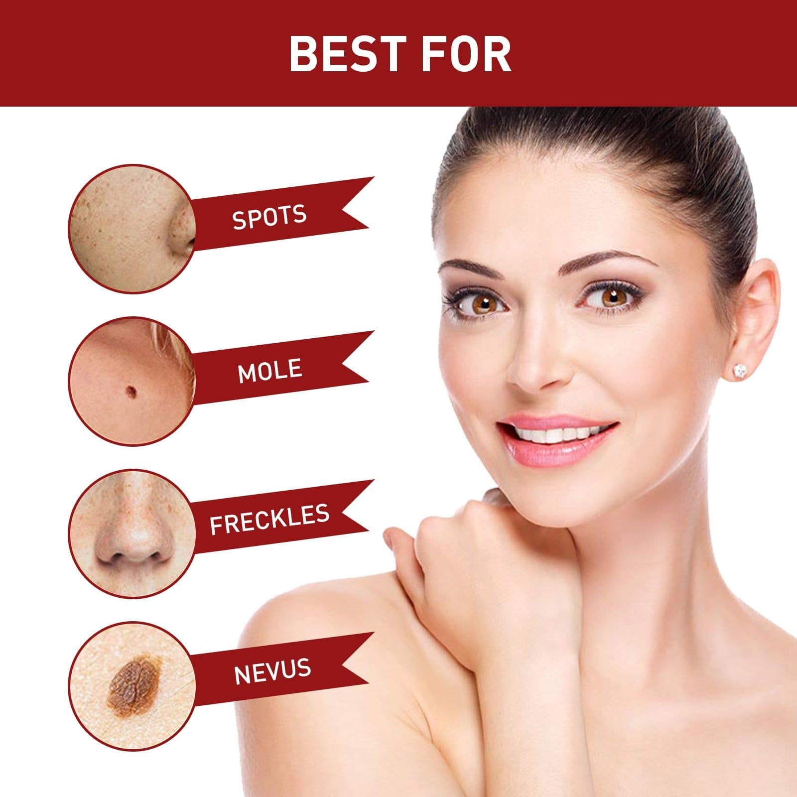 image-Wart Removal Mole Spot Essential Oil 20ml