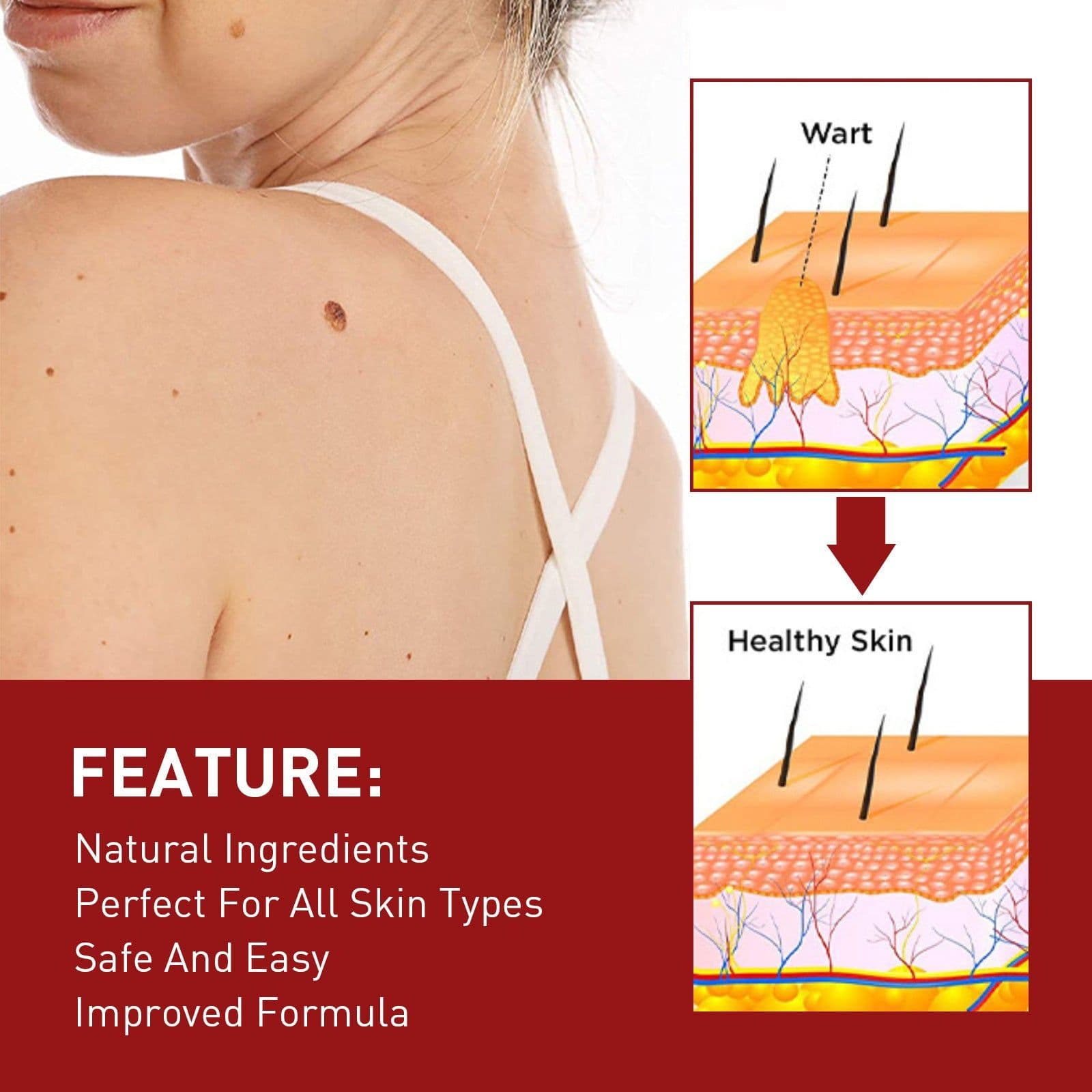 image-Wart & Mole Removal Essential Oil - Skin Lightening Treatment