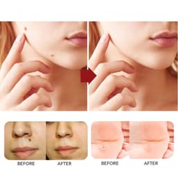 image-Wart & Mole Removal Essential Oil - Skin Lightening Treatment
