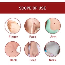 image-Wart & Mole Removal Essential Oil - Skin Lightening Treatment