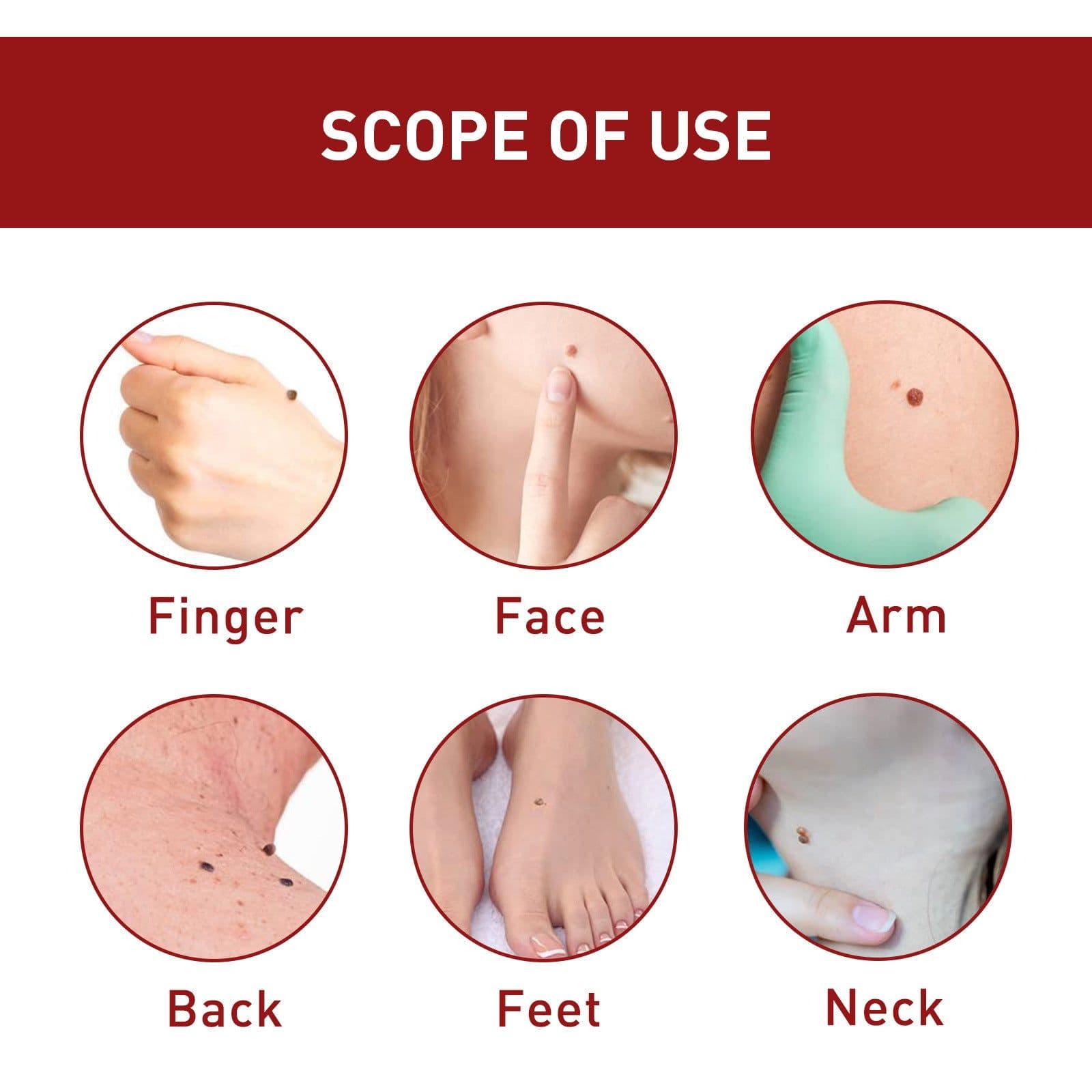image-Wart & Mole Removal Essential Oil - Skin Lightening Treatment