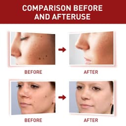 image-Wart & Mole Removal Essential Oil - Skin Lightening Treatment