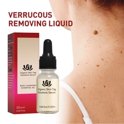 image-Wart & Mole Removal Essential Oil - Skin Lightening Treatment