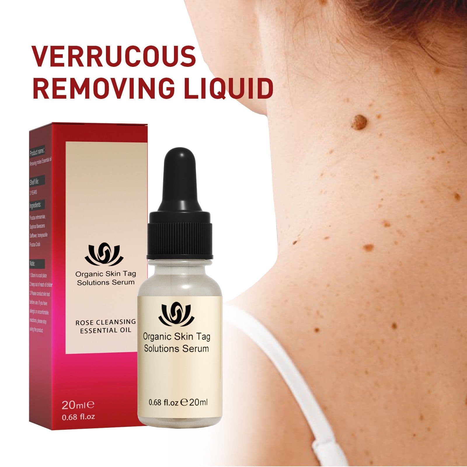 image-Wart & Mole Removal Essential Oil - Skin Lightening Treatment