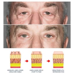 image-Men's Anti-Aging Eye Cream for Fine Lines Dark Circles 15g