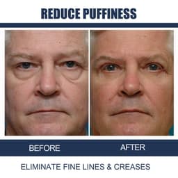 image-Men's Anti-Aging Eye Cream for Fine Lines Dark Circles 15g