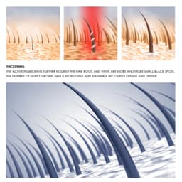 image-South Moon Anti-Loss Dense Hair Essence Nutrient Solution