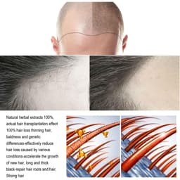 image-South Moon Anti-Loss Dense Hair Essence Nutrient Solution