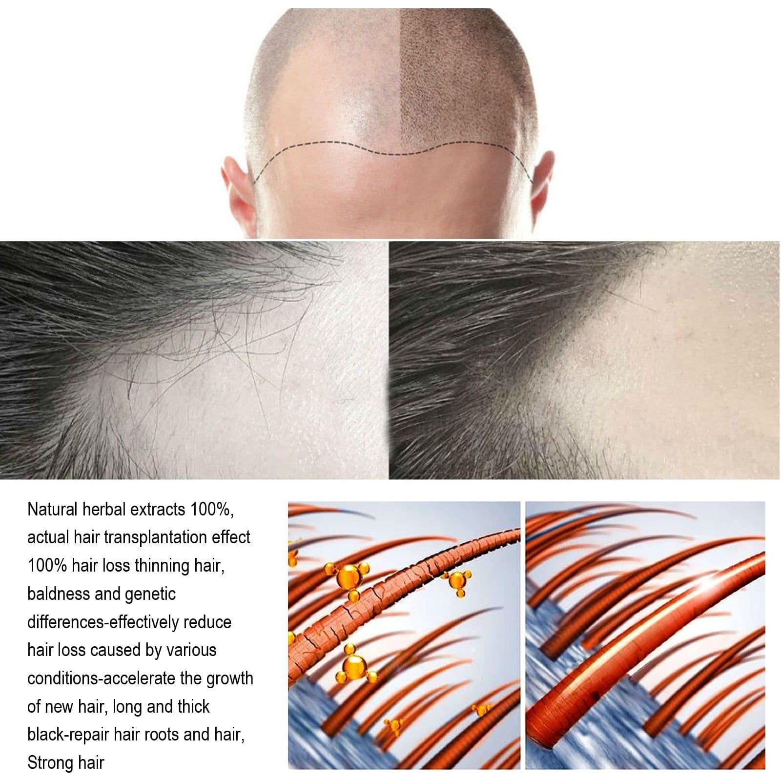 image-South Moon Anti-Loss Dense Hair Essence Nutrient Solution