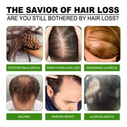 image-South Moon Anti-Loss Dense Hair Essence Nutrient Solution
