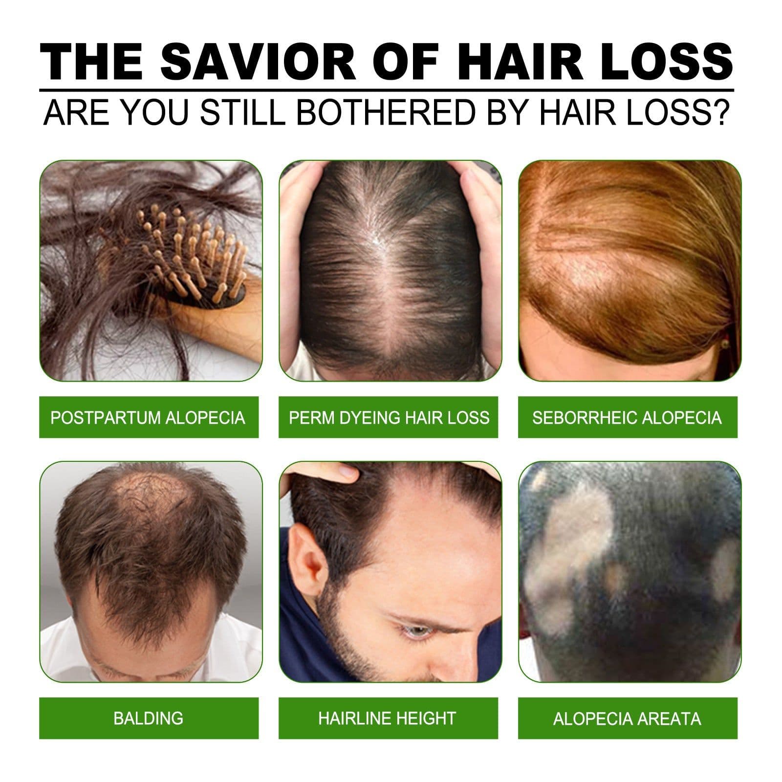 image-South Moon Anti-Loss Dense Hair Essence Nutrient Solution