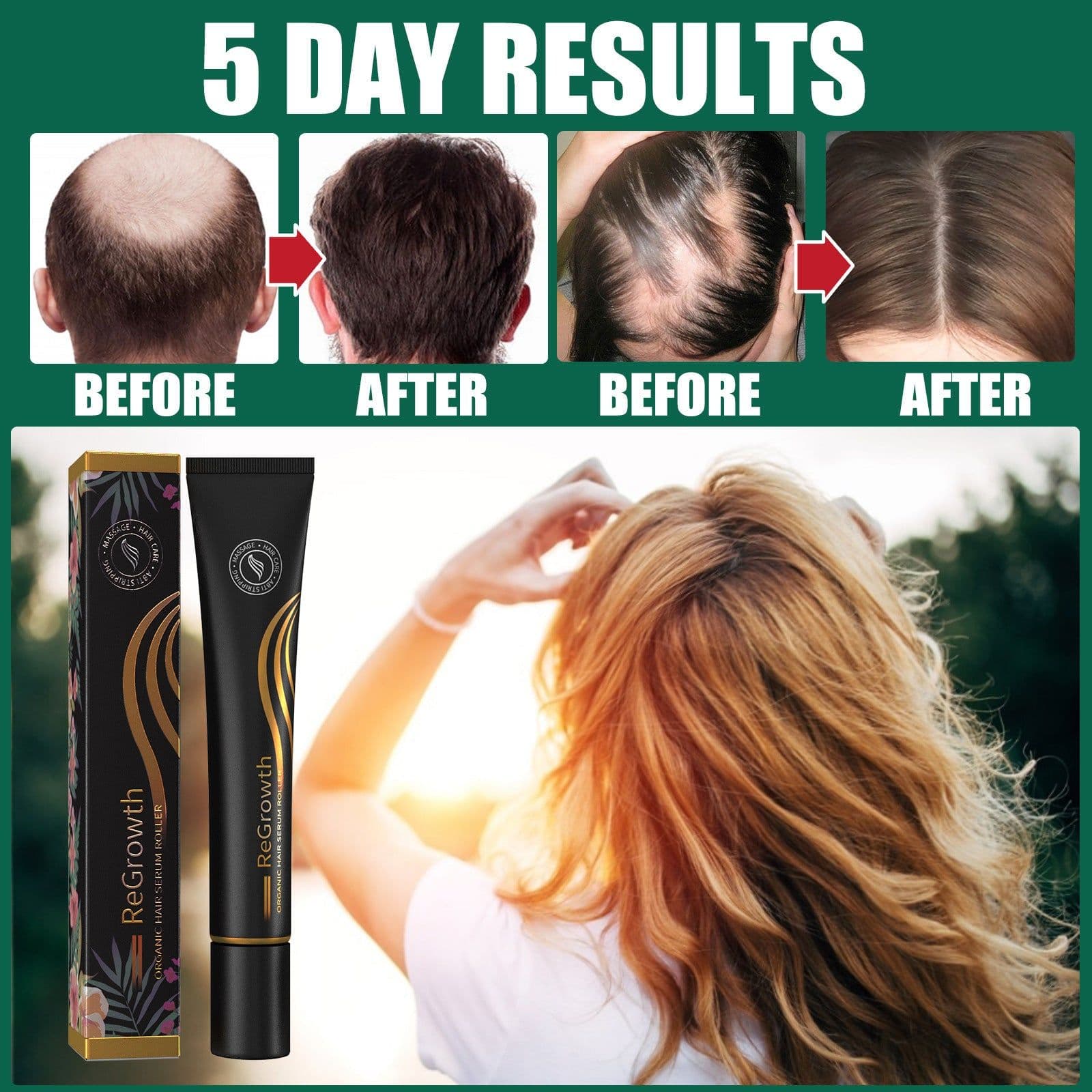 image-EELHOE Roll-On Hair Oil Scalp Treatment for Thick and Thin Hair