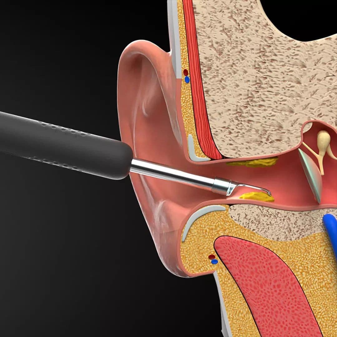 image-bebird R1 HD Wireless Visual Ear Pick with Ear Suction