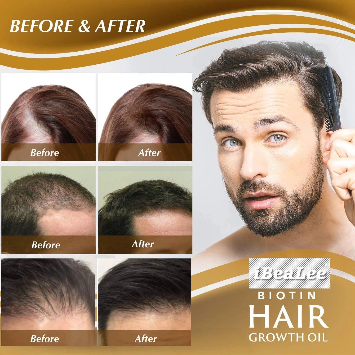 image-iBraLee Hair Growth Anti-Loss Essence 20ml
