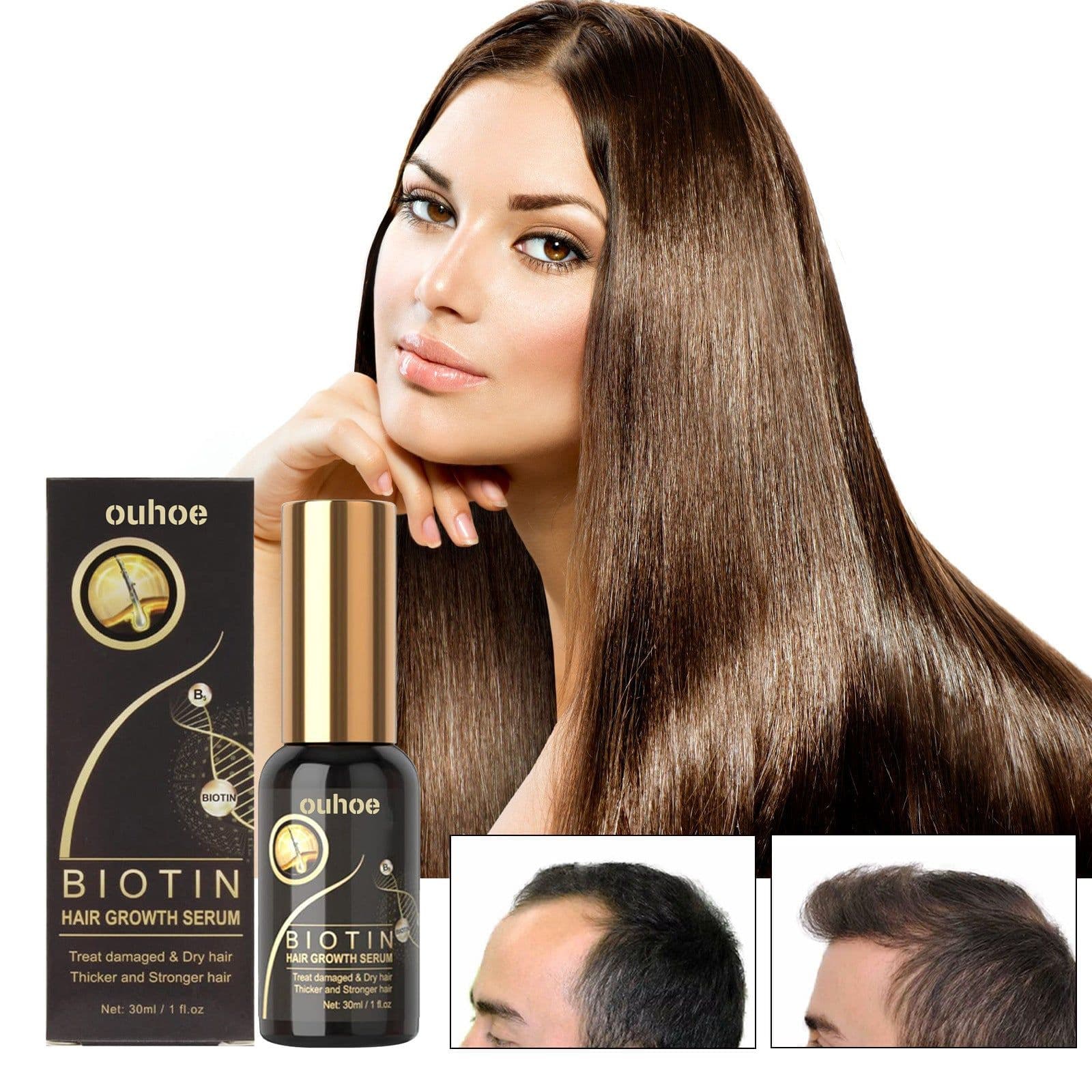 image-OUHOE Biotin Dense Hair Essence