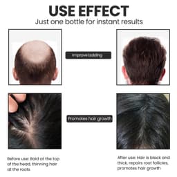 image-OUHOE Biotin Dense Hair Essence