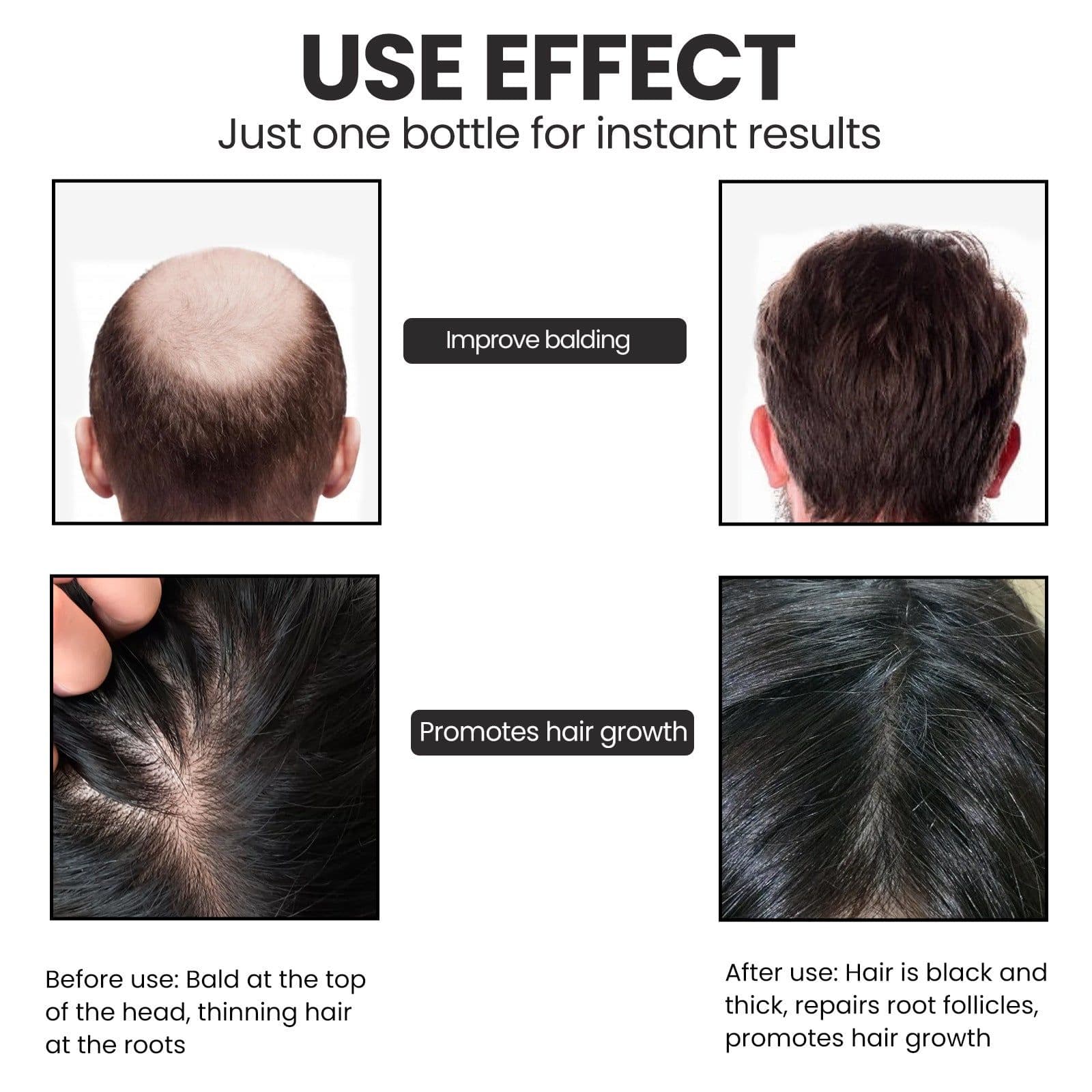 image-OUHOE Biotin Dense Hair Essence