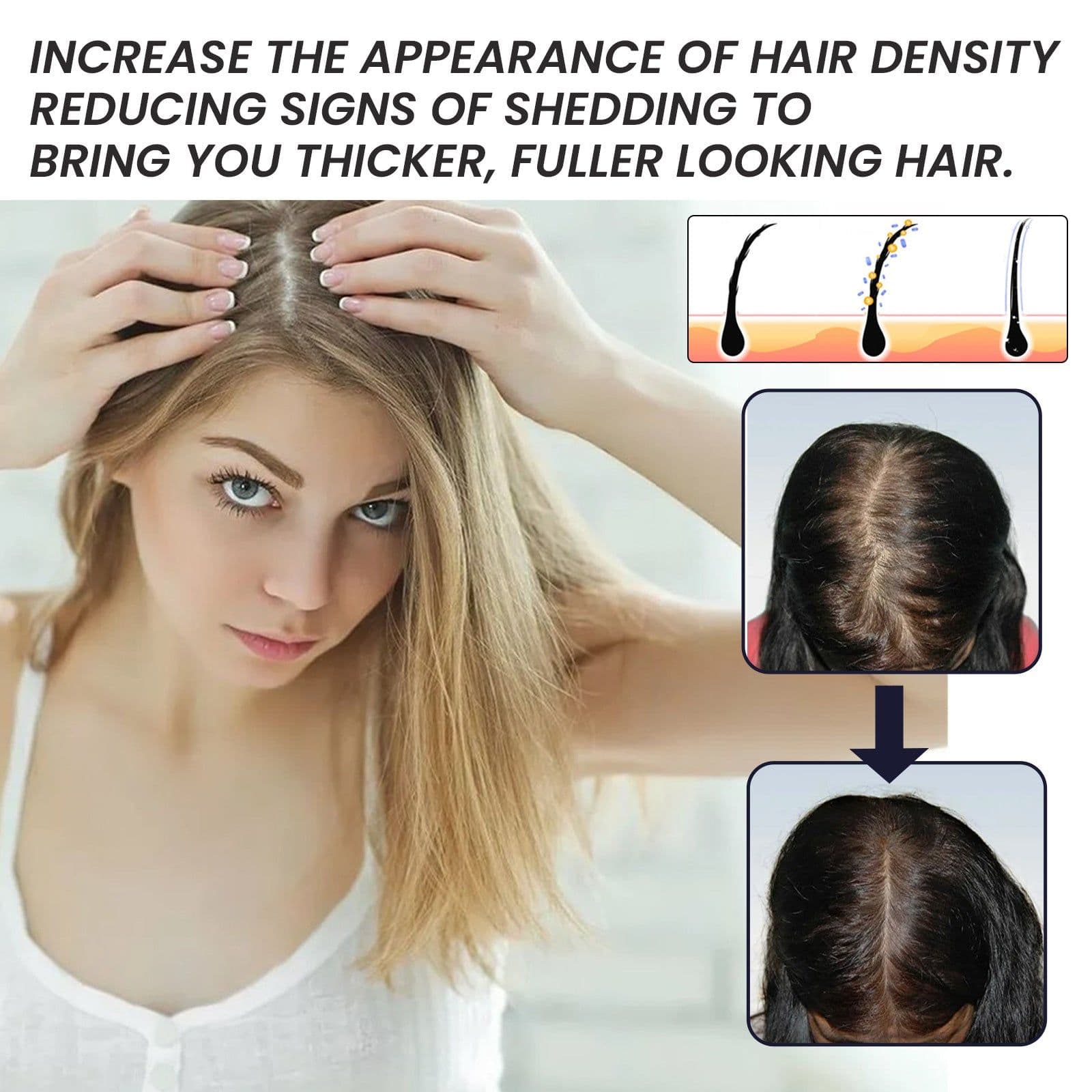 image-OUHOE Biotin Dense Hair Essence