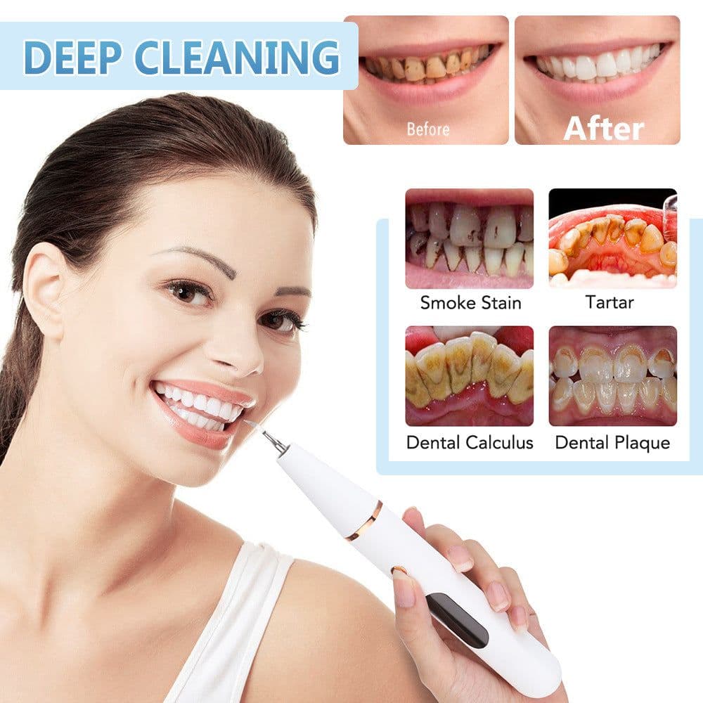 image-HailiCare Ultrasonic Dental Cleaner Portable Tooth Stain Remover