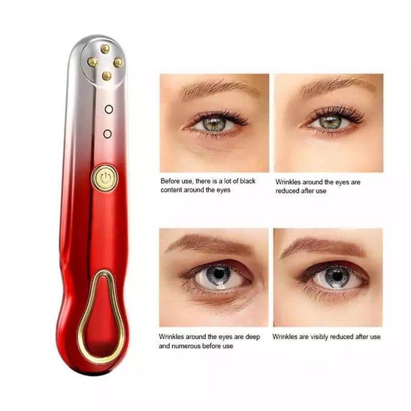 image-RF Radio Frequency Eye Massager Anti-Ageing Wrinkle Massager Portable Electric Device Dark Circle Facials Vibration Massage Pen