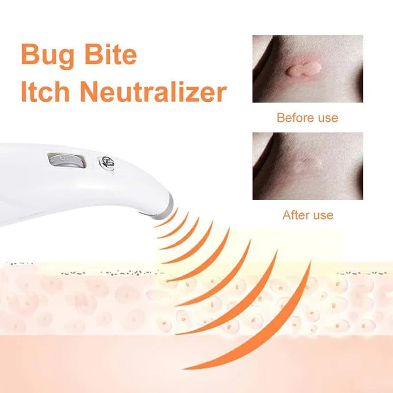 image-Electric Mosquito Bite Antipruritic Device Mosquito Bite Relief Device Children Adult Mosquito Bite Antipruritic Anti-itch Pen