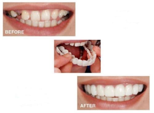 image-Teeth Whitening Snap On Smile Teeth Cosmetic Denture Instant Perfect Smile Teeth Fake Tooth Cover One Size Fits