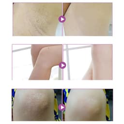 image-Aichun repair whitening black pigment to prevent odor, sweat to smell, armpit whitening skin 50g