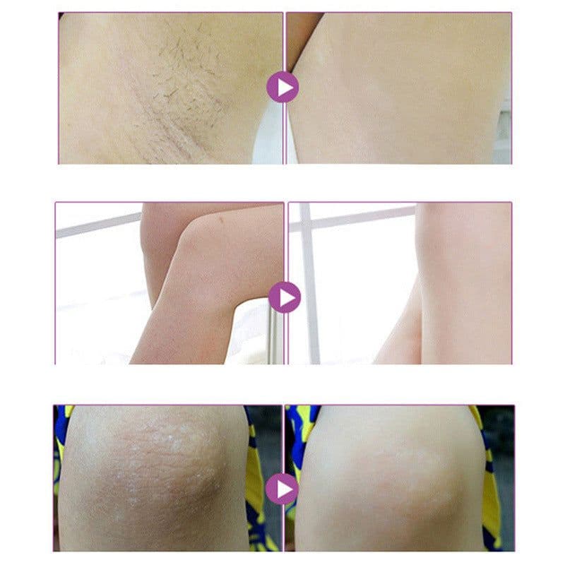 image-Aichun repair whitening black pigment to prevent odor, sweat to smell, armpit whitening skin 50g