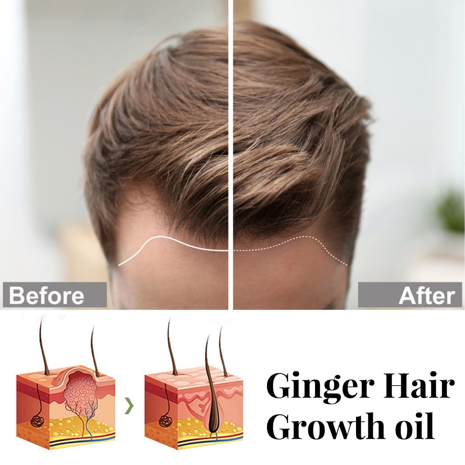 image-Ginger Repair Hair Follicle Soft Moisturizing And Nourishing Essential Oil