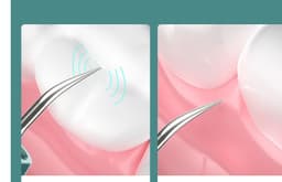 image-New High-definition Visual Dental Cleaner