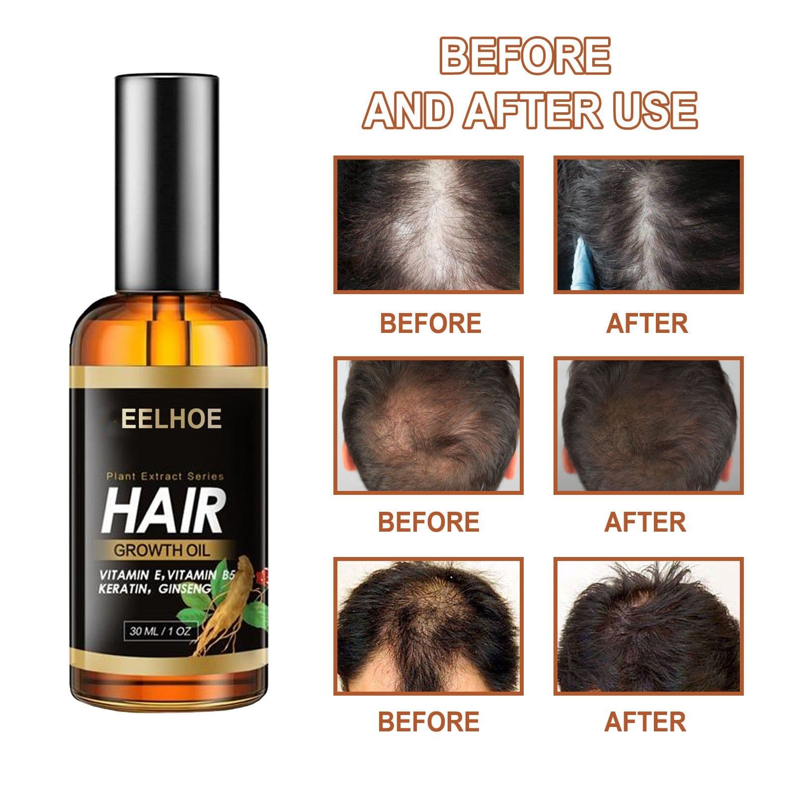 image-EELHOE Herb Hair Hairdressing Hair Care Essential Oil Hair Strong Hair Reduce Hair Loss Broken Hair Hair Care Essential Oil