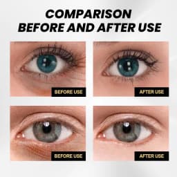 image-EELHOE Instant Firming Eye Cream Reduces eye bags, fades wrinkles and dark circles, moisturizes and tightens the skin around the eyes