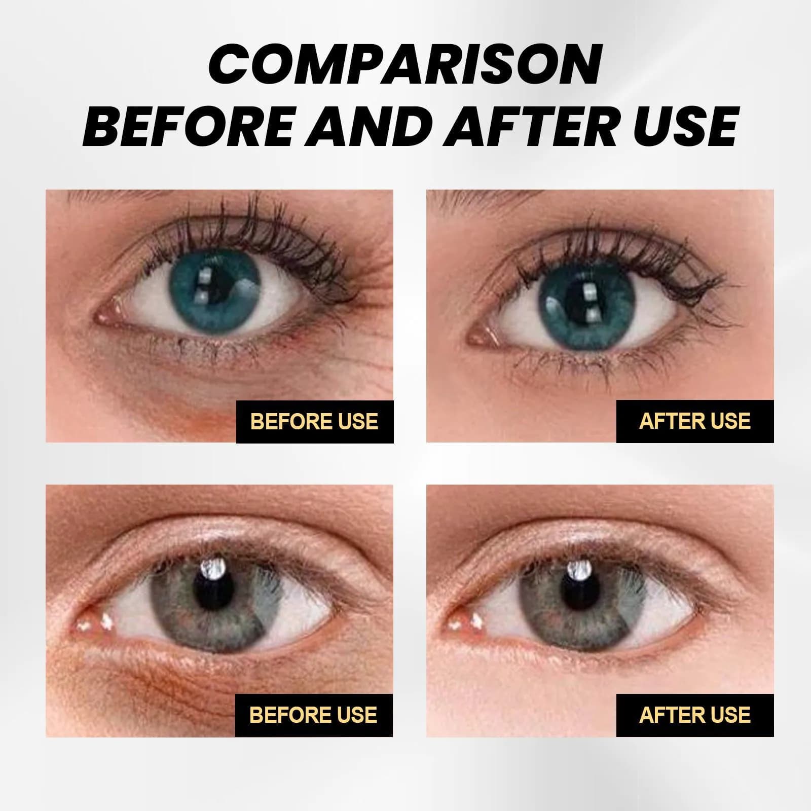 image-EELHOE Instant Firming Eye Cream Reduces eye bags, fades wrinkles and dark circles, moisturizes and tightens the skin around the eyes