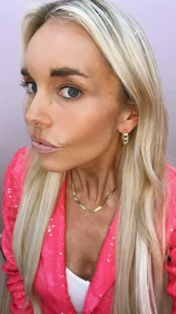 image-Curb Link Chain Hoop Earrings
