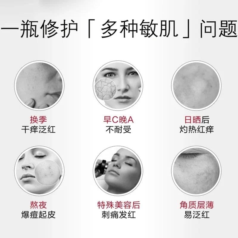 image-Winona Soothing Sensitive Moisturising Face Cream 15ML Sensitive Skin Hydration Barrier Repair Cream Highly Recommend Skincare