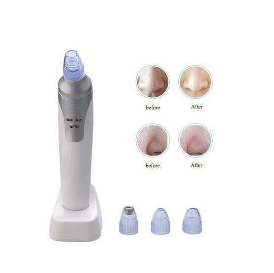 image-Electronic Blackhead Remover