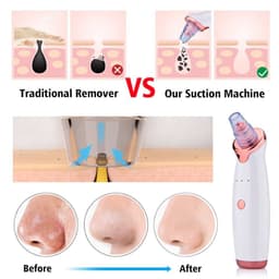 image-Blackhead Instrument Electric Suction Facial Washing Instrument Beauty Acne Cleaning Blackhead Suction Instrument