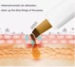 image-Ultrasonic beauty instrument