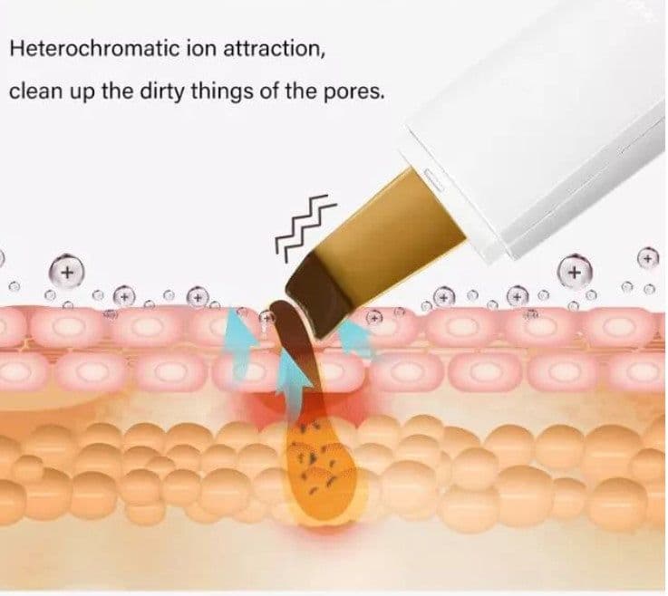 image-Ultrasonic beauty instrument