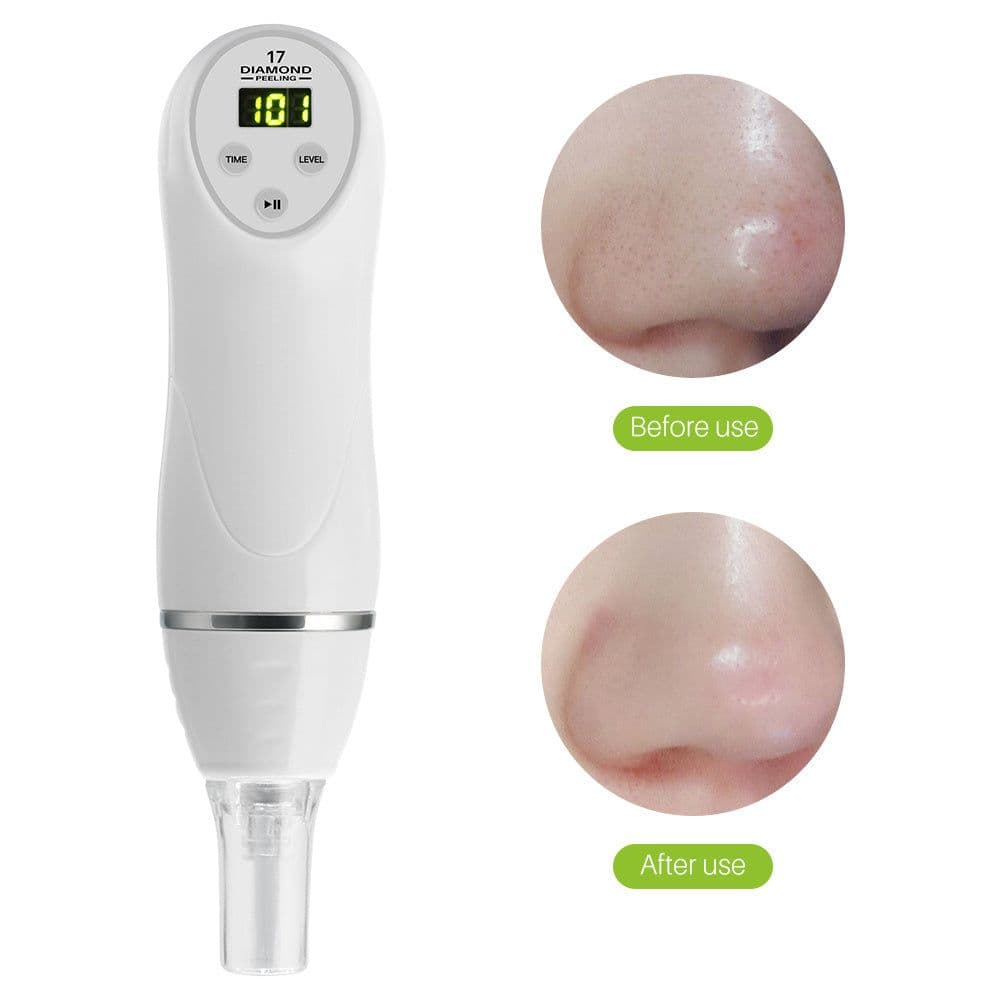 image-Electric pore suction and acne removing device beauty cleaner