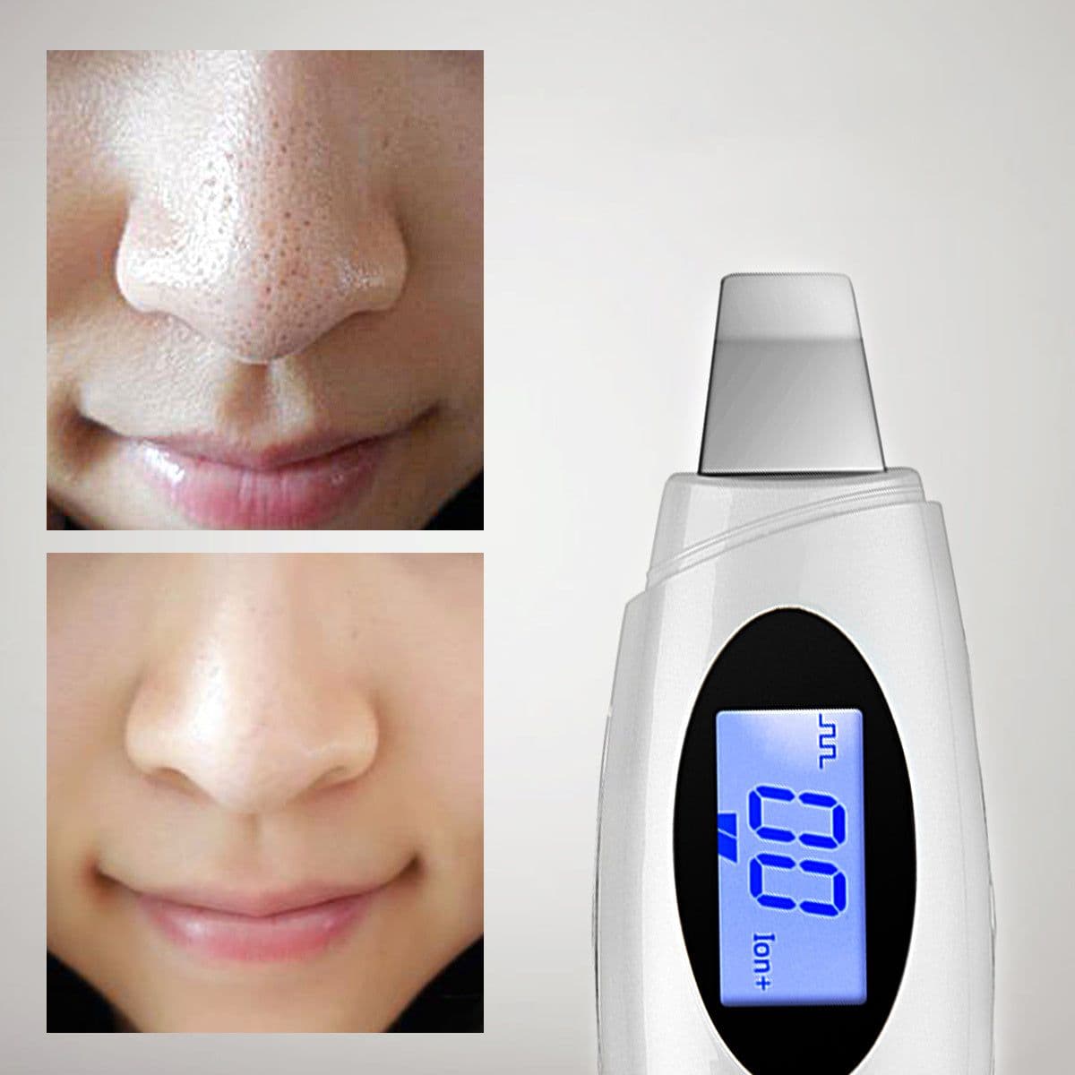 image-Ultrasonic beauty instrument