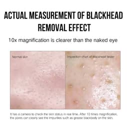 image-Facial Blackhead Remover