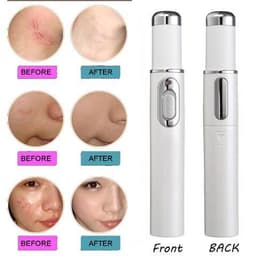 image-Blue Light Therapy Acne Laser Pen Soft Scar Wrinkle Removal Treatment Device Skin Care Beauty Equipment